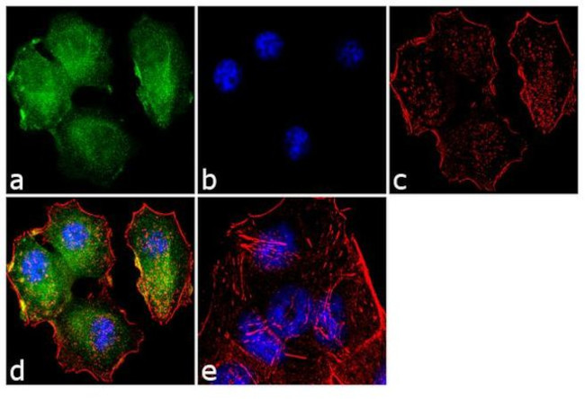 TSC2 Antibody in Immunocytochemistry (ICC/IF)