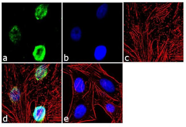 SETD7 Antibody in Immunocytochemistry (ICC/IF)