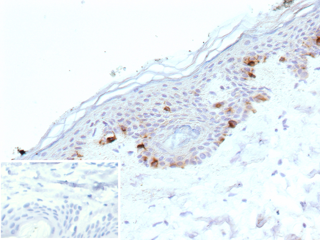 Tyrosinase-Related Protein-1 (TYRP-1) (Melanoma Marker) Antibody in Immunohistochemistry (Paraffin) (IHC (P))