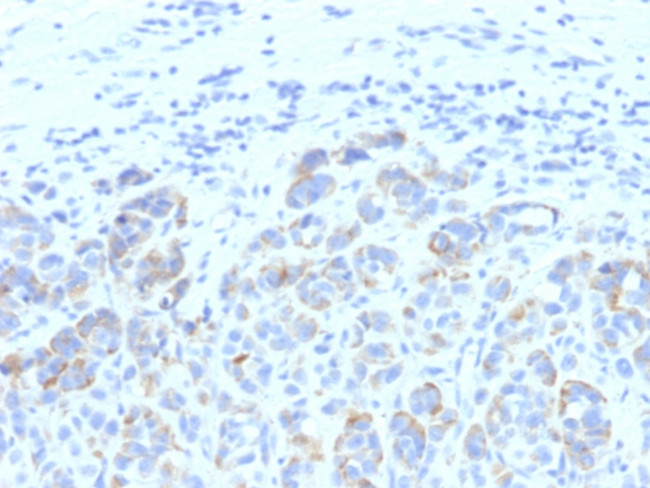 Tyrosinase-Related Protein-1 (TYRP-1) (Melanoma Marker) Antibody in Immunohistochemistry (Paraffin) (IHC (P))