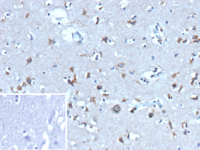 Ubiquitin (Autophagy Marker) Antibody in Immunohistochemistry (Paraffin) (IHC (P))