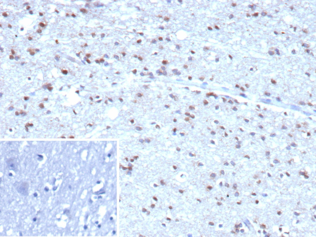 Ubiquitin (Autophagy Marker) Antibody in Immunohistochemistry (Paraffin) (IHC (P))