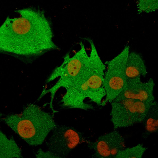 PGP9.5/UchL1 (pan-Neuronal Marker) Antibody in Immunocytochemistry (ICC/IF)