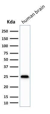 PGP9.5/UchL1 Antibody in Western Blot (WB)