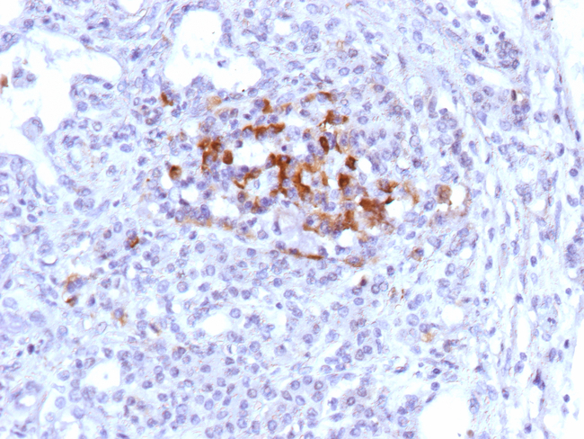 Complement Component C9 (CCC9) (Early Myocardial Infarction Marker) Antibody in Immunohistochemistry (Paraffin) (IHC (P))