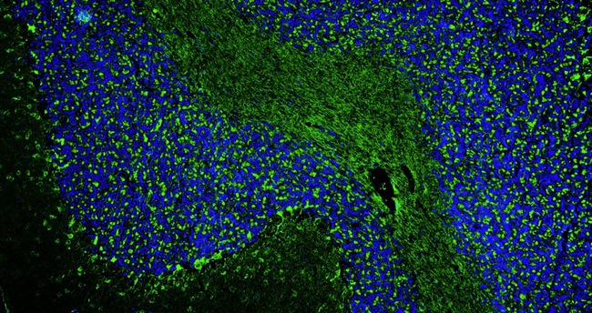PSD-95 Antibody in Immunohistochemistry (IHC)