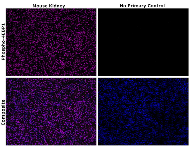 Phospho-4EBP1 (Thr36, Thr45) Antibody in Immunohistochemistry (Paraffin) (IHC (P))
