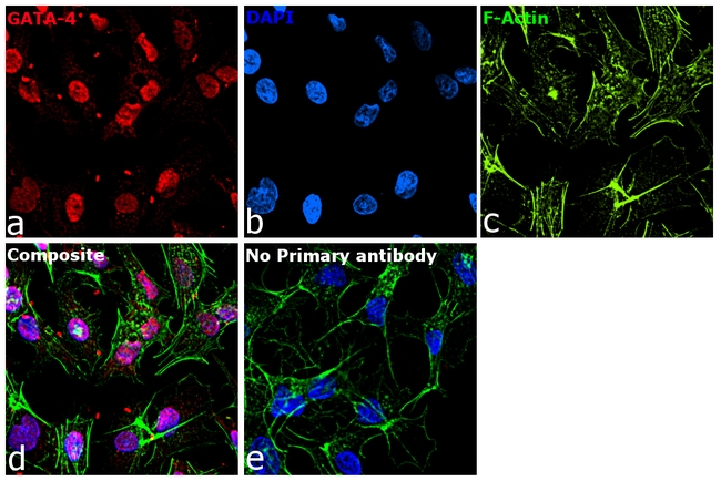 GATA4 Antibody in Immunocytochemistry (ICC/IF)