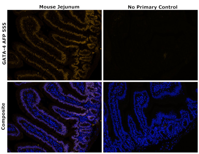 GATA4 Antibody in Immunohistochemistry (Paraffin) (IHC (P))