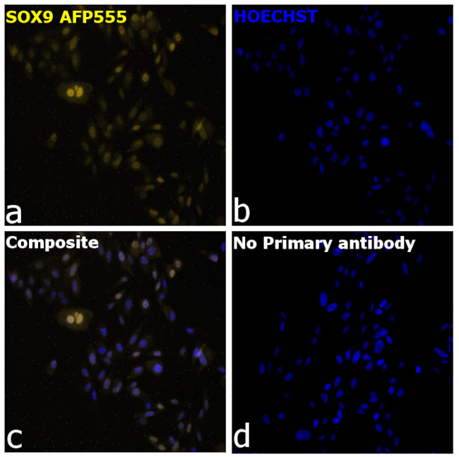 SOX9 Antibody in Immunocytochemistry (ICC/IF)