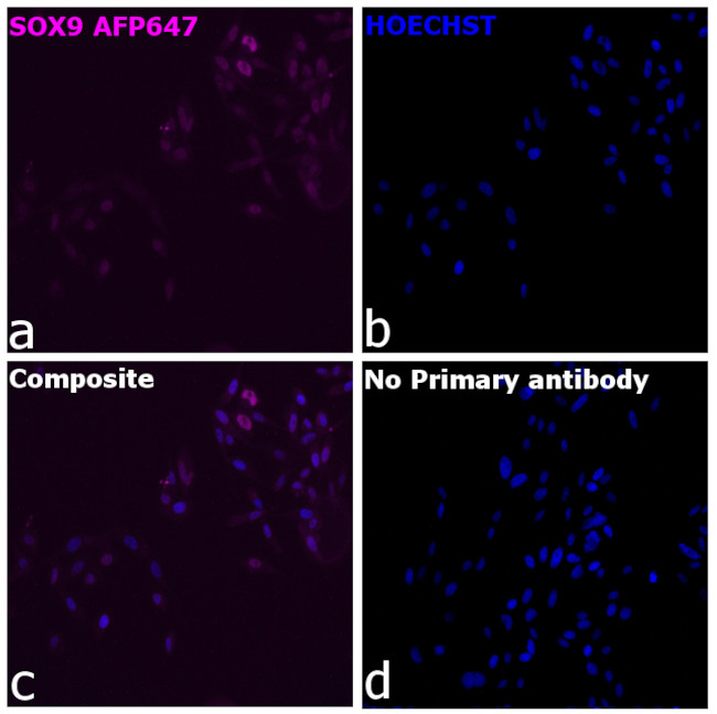 SOX9 Antibody in Immunocytochemistry (ICC/IF)