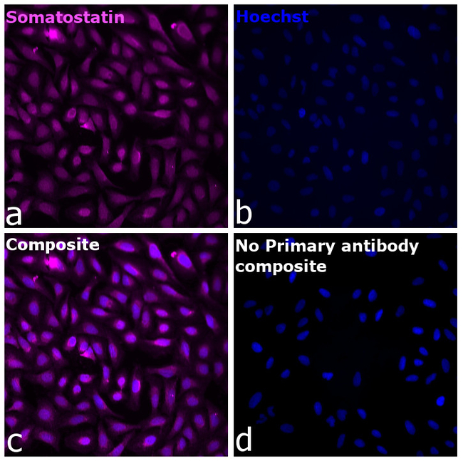 Somatostatin Antibody in Immunocytochemistry (ICC/IF)