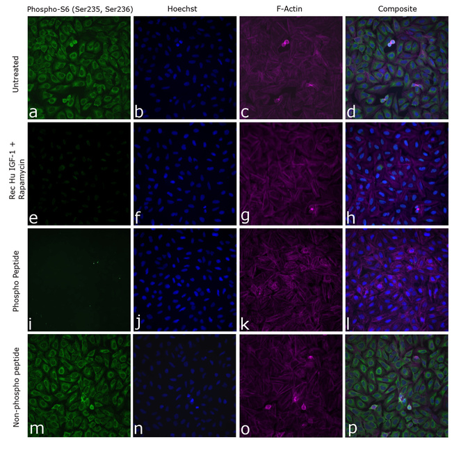Phospho-S6 (Ser235, Ser236) Antibody in Immunocytochemistry (ICC/IF)