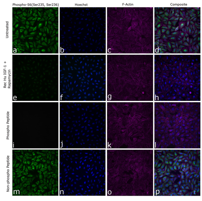 Phospho-S6 (Ser235, Ser236) Antibody in Immunocytochemistry (ICC/IF)