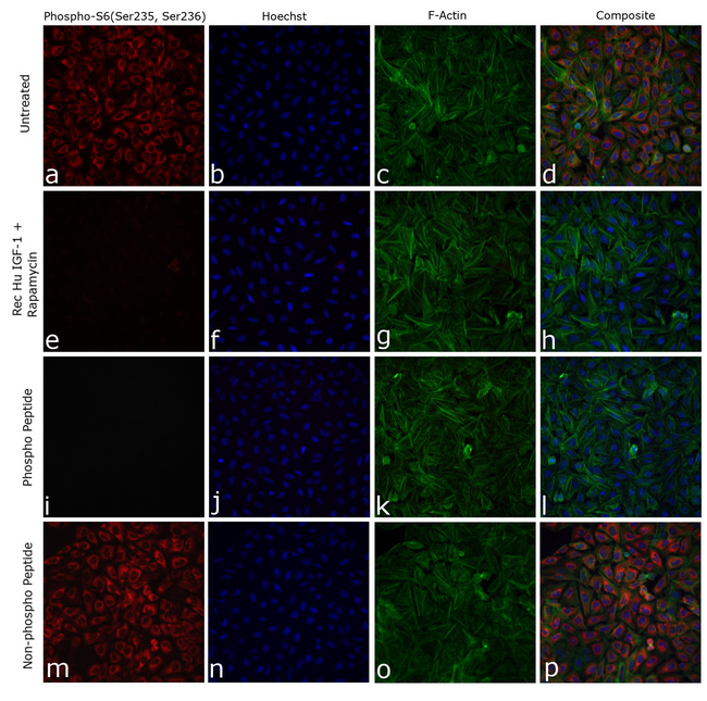 Phospho-S6 (Ser235, Ser236) Antibody in Immunocytochemistry (ICC/IF)