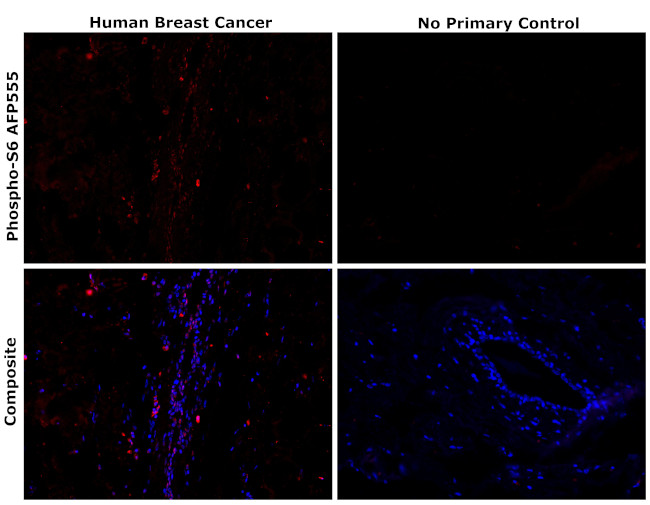 Phospho-S6 (Ser235, Ser236) Antibody in Immunohistochemistry (Paraffin) (IHC (P))