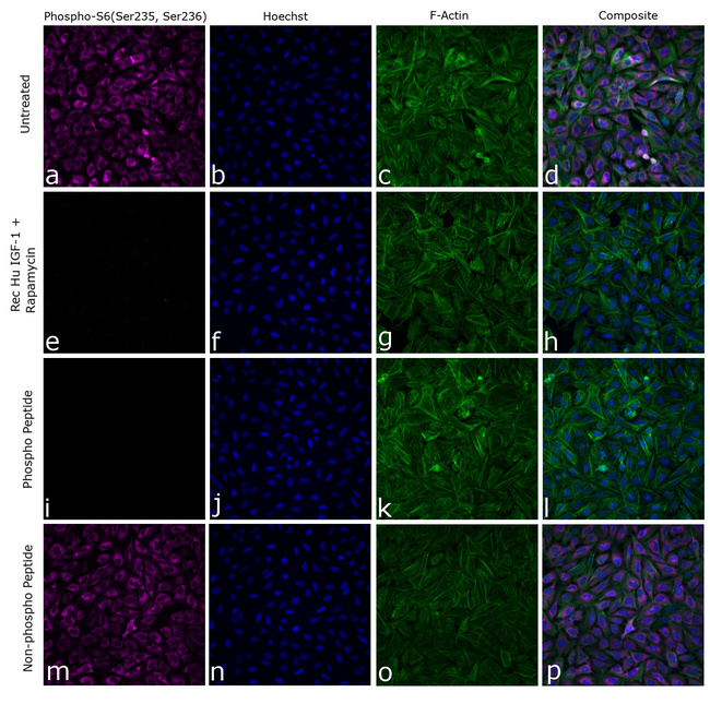 Phospho-S6 (Ser235, Ser236) Antibody in Immunocytochemistry (ICC/IF)