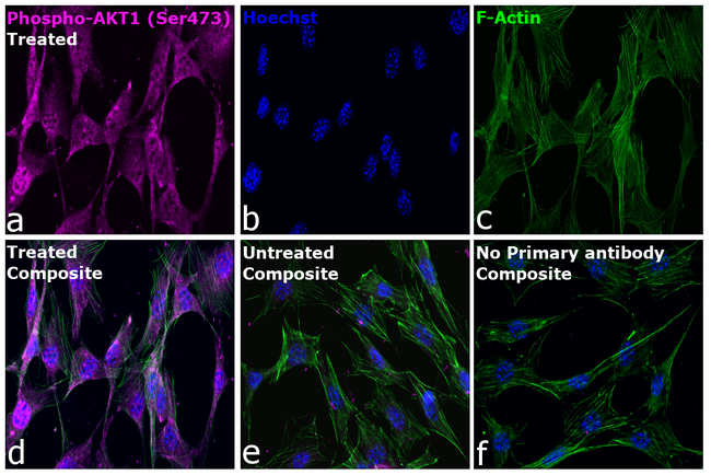 Phospho-AKT1 (Ser473) Antibody in Immunocytochemistry (ICC/IF)