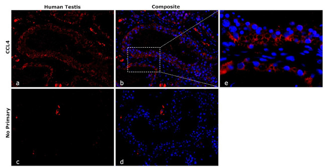 CCL4 (MIP-1 beta) Antibody in Immunohistochemistry (Paraffin) (IHC (P))