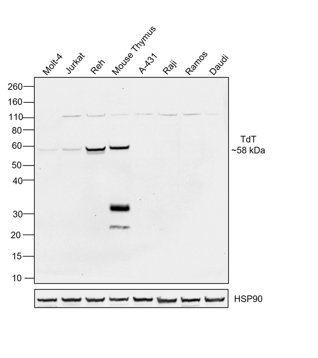 TdT Antibody in Western Blot (WB)