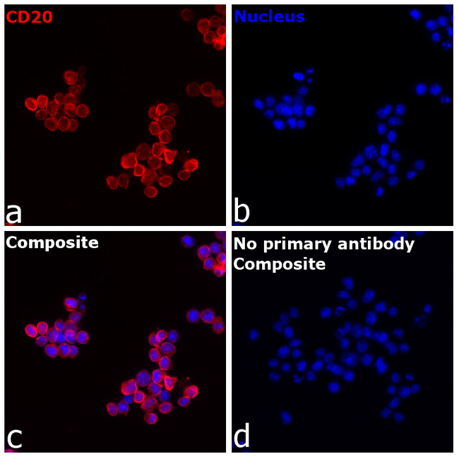 CD20 Antibody in Immunocytochemistry (ICC/IF)