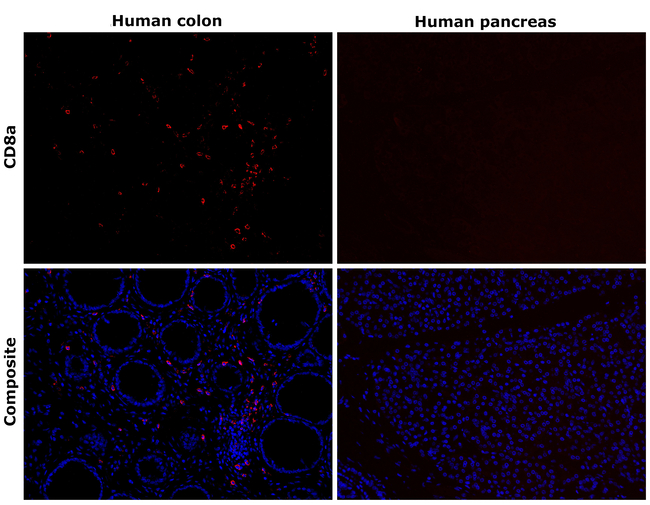 CD8a Antibody in Immunohistochemistry (Paraffin) (IHC (P))