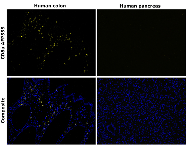 CD8a Antibody in Immunohistochemistry (Paraffin) (IHC (P))
