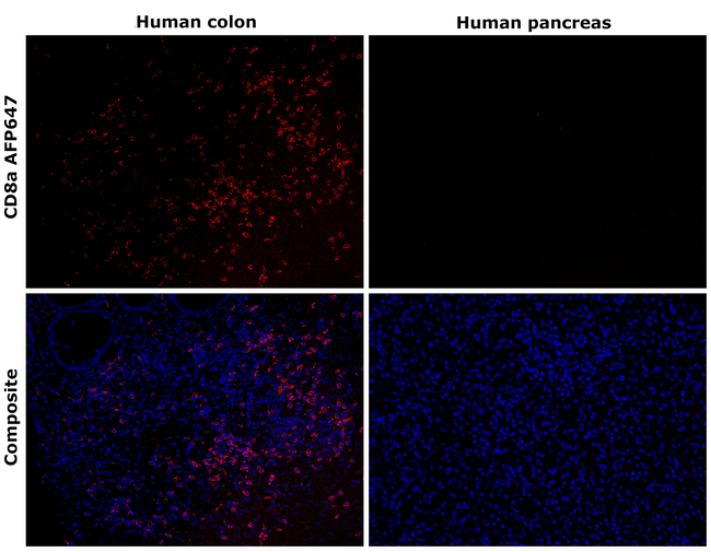 CD8a Antibody in Immunohistochemistry (Paraffin) (IHC (P))