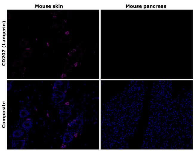 CD207 (Langerin) Antibody in Immunohistochemistry (Paraffin) (IHC (P))