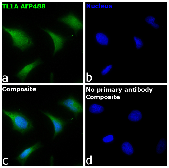 TL1A Antibody in Immunocytochemistry (ICC/IF)