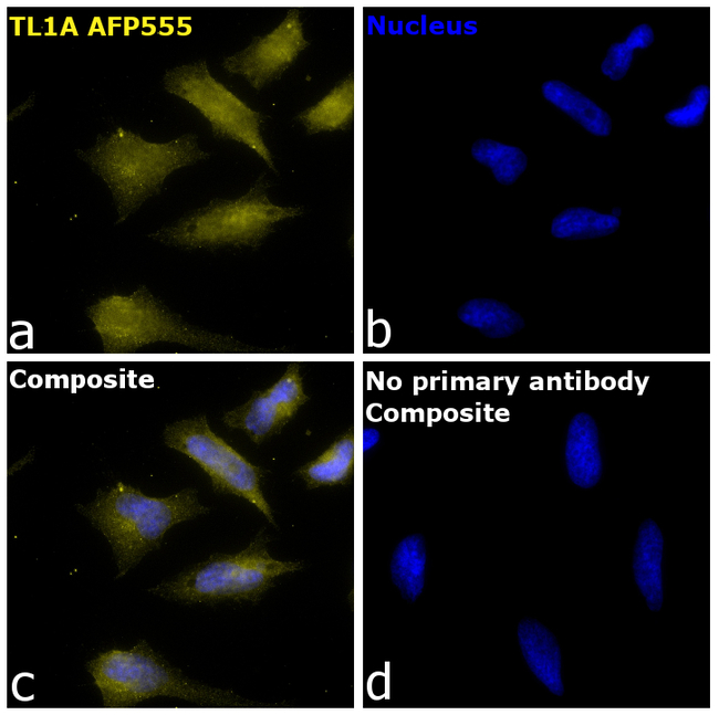 TL1A Antibody in Immunocytochemistry (ICC/IF)
