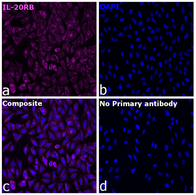 IL-20RB Antibody in Immunocytochemistry (ICC/IF)