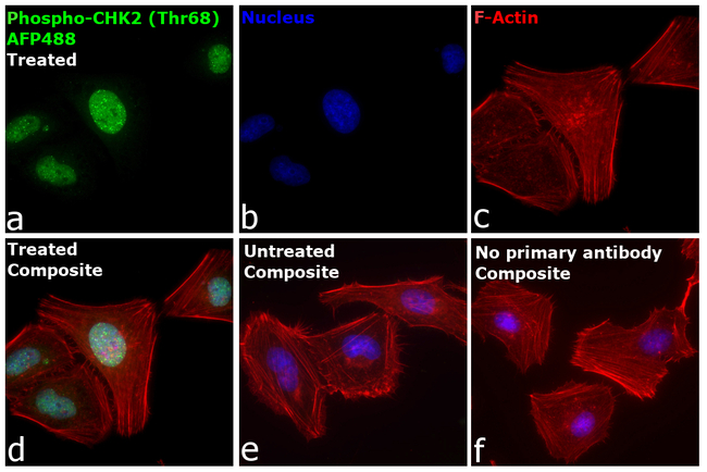 Phospho-CHK2 (Thr68) Antibody in Immunocytochemistry (ICC/IF)