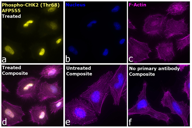 Phospho-CHK2 (Thr68) Antibody in Immunocytochemistry (ICC/IF)
