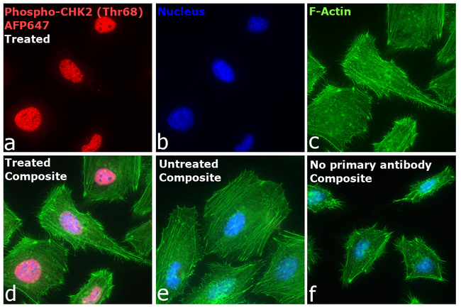 Phospho-CHK2 (Thr68) Antibody in Immunocytochemistry (ICC/IF)