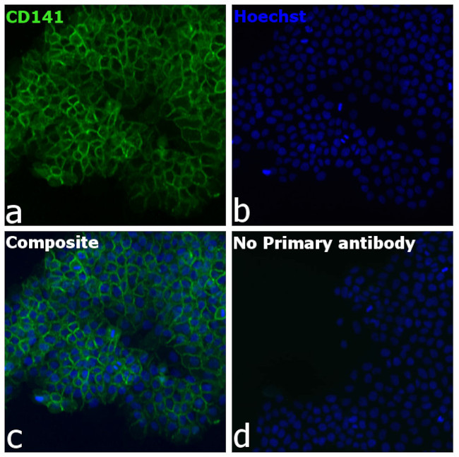 CD141 Antibody in Immunocytochemistry (ICC/IF)