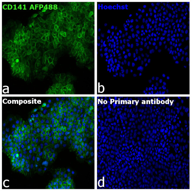 CD141 Antibody in Immunocytochemistry (ICC/IF)