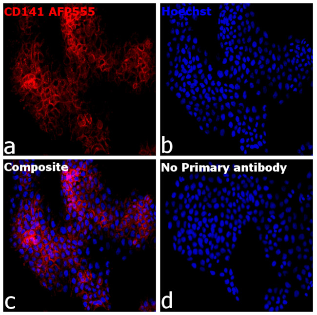 CD141 Antibody in Immunocytochemistry (ICC/IF)