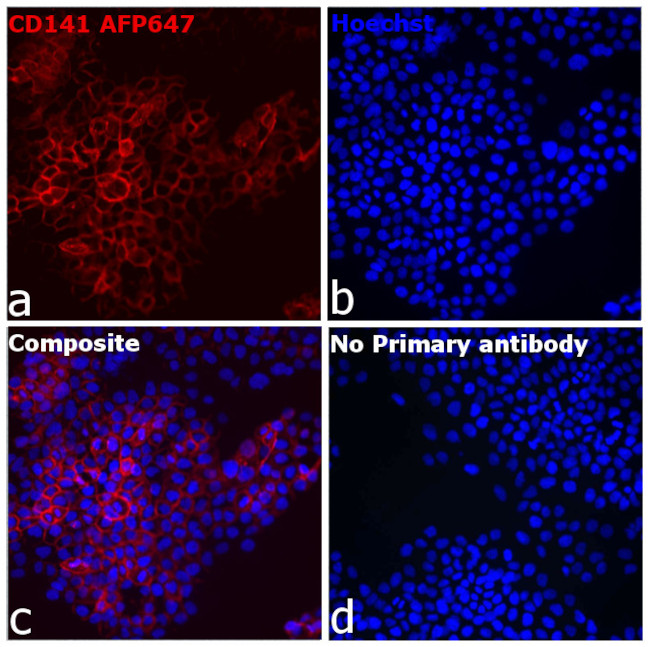 CD141 Antibody in Immunocytochemistry (ICC/IF)