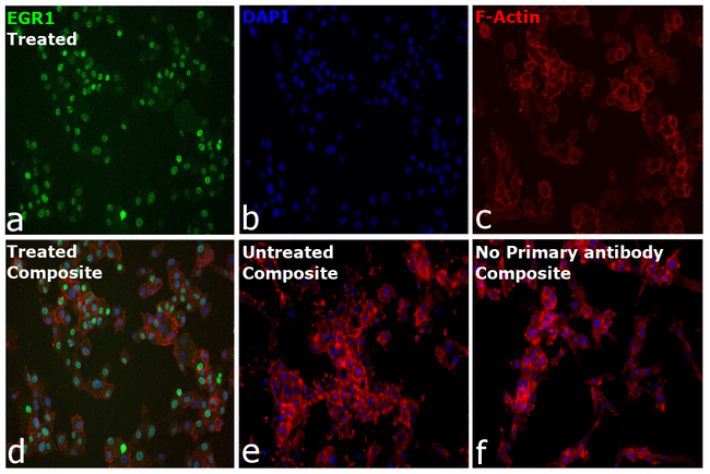 EGR1 Antibody in Immunocytochemistry (ICC/IF)