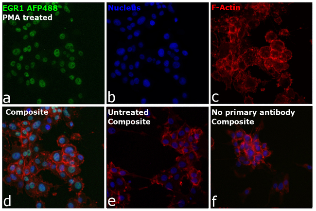 EGR1 Antibody in Immunocytochemistry (ICC/IF)