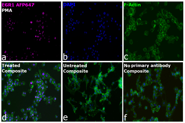 EGR1 Antibody in Immunocytochemistry (ICC/IF)