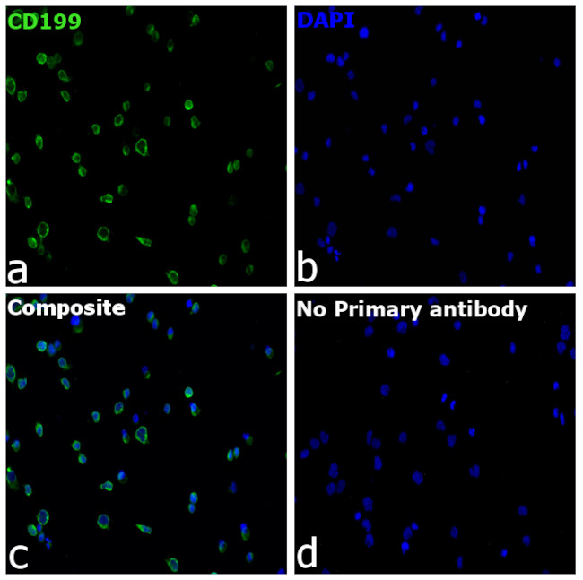 CD199 (CCR9) Antibody in Immunocytochemistry (ICC/IF)