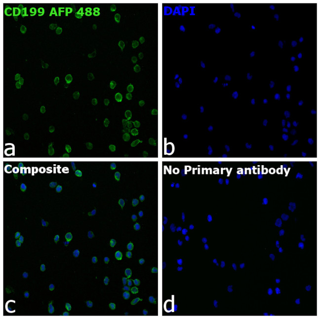 CD199 (CCR9) Antibody in Immunocytochemistry (ICC/IF)