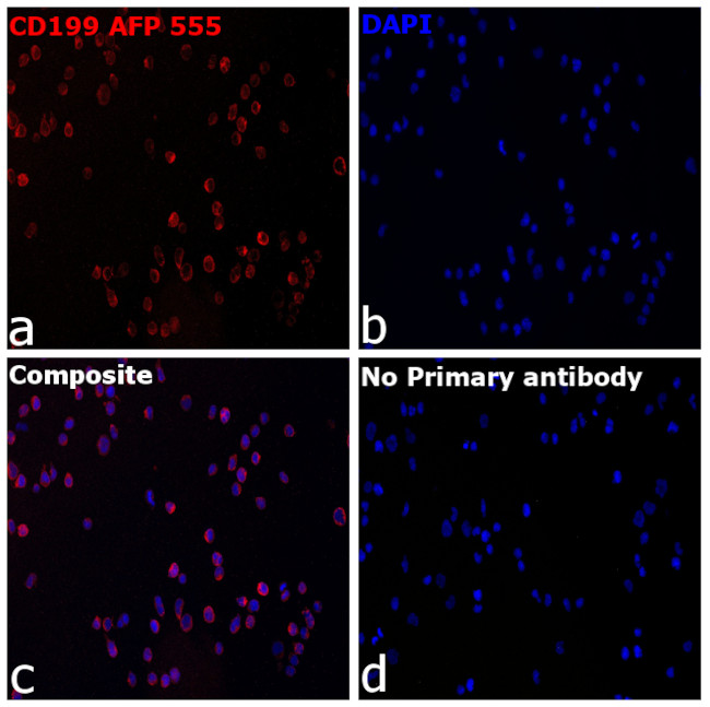 CD199 (CCR9) Antibody in Immunocytochemistry (ICC/IF)