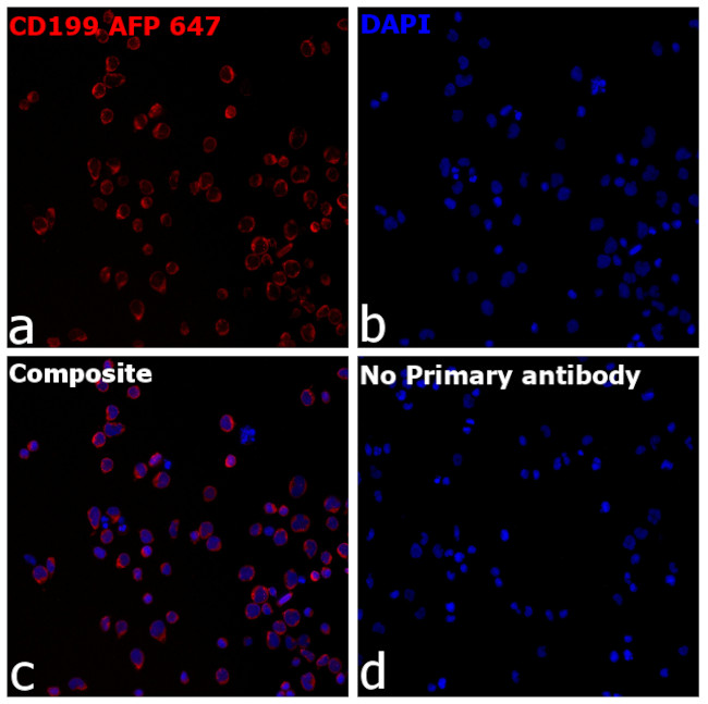 CD199 (CCR9) Antibody in Immunocytochemistry (ICC/IF)