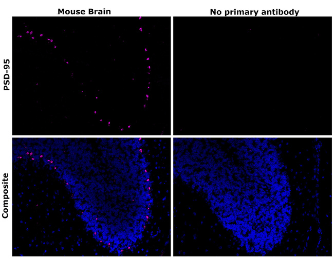 PSD-95 Antibody in Immunohistochemistry (Paraffin) (IHC (P))