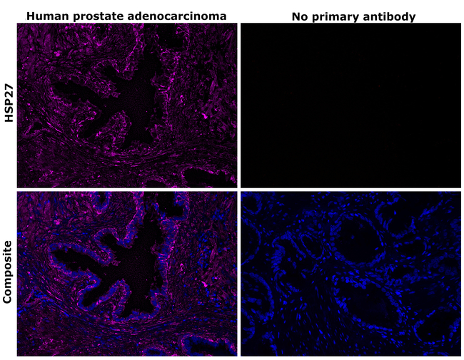 HSP27 Antibody in Immunohistochemistry (Paraffin) (IHC (P))