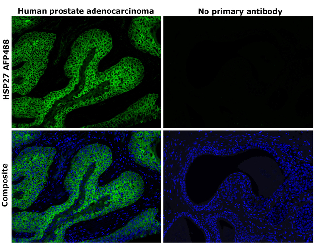 HSP27 Antibody in Immunohistochemistry (Paraffin) (IHC (P))