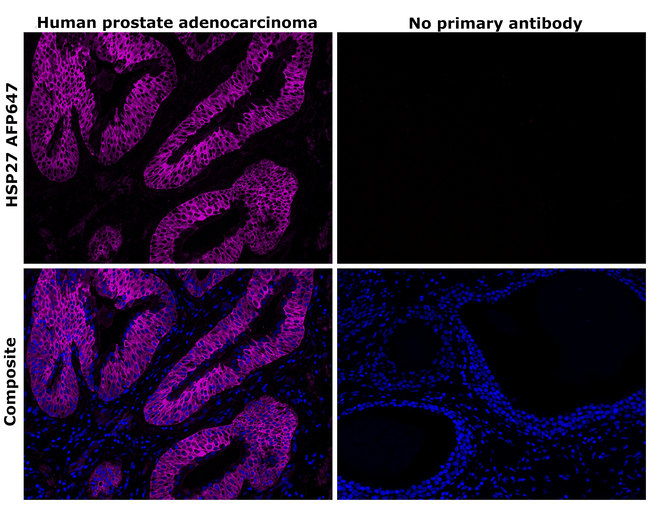 HSP27 Antibody in Immunohistochemistry (Paraffin) (IHC (P))